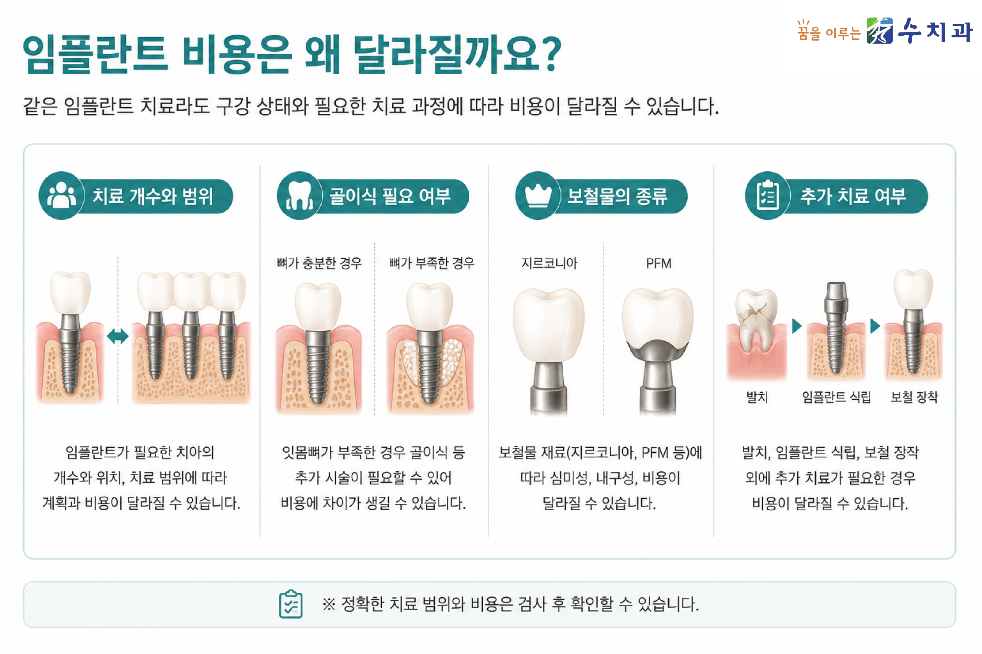 임플란트 비용이 달라지는 주요 요인