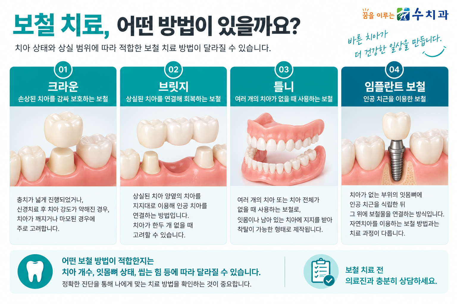 크라운 브릿지 틀니 임플란트 보철 치료 종류와 차이