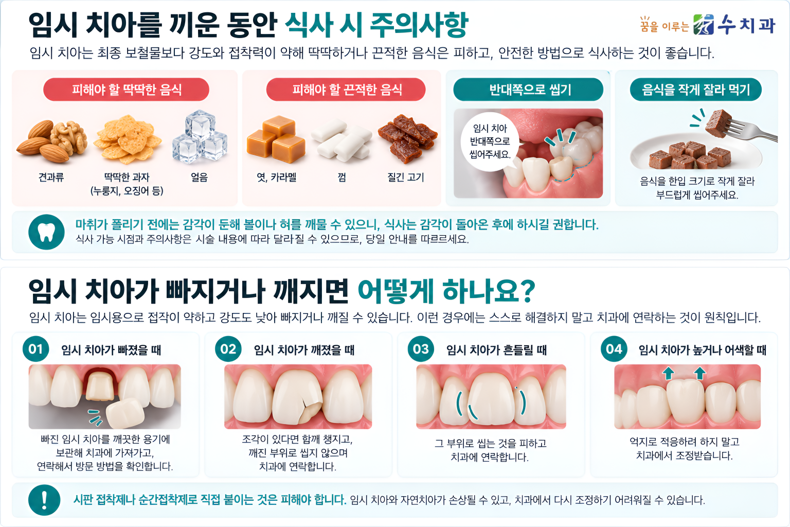 임시 치아 착용 중 피해야 할 음식과 식사 방법, 임시 치아가 빠지거나 깨졌을 때의 대처 방법