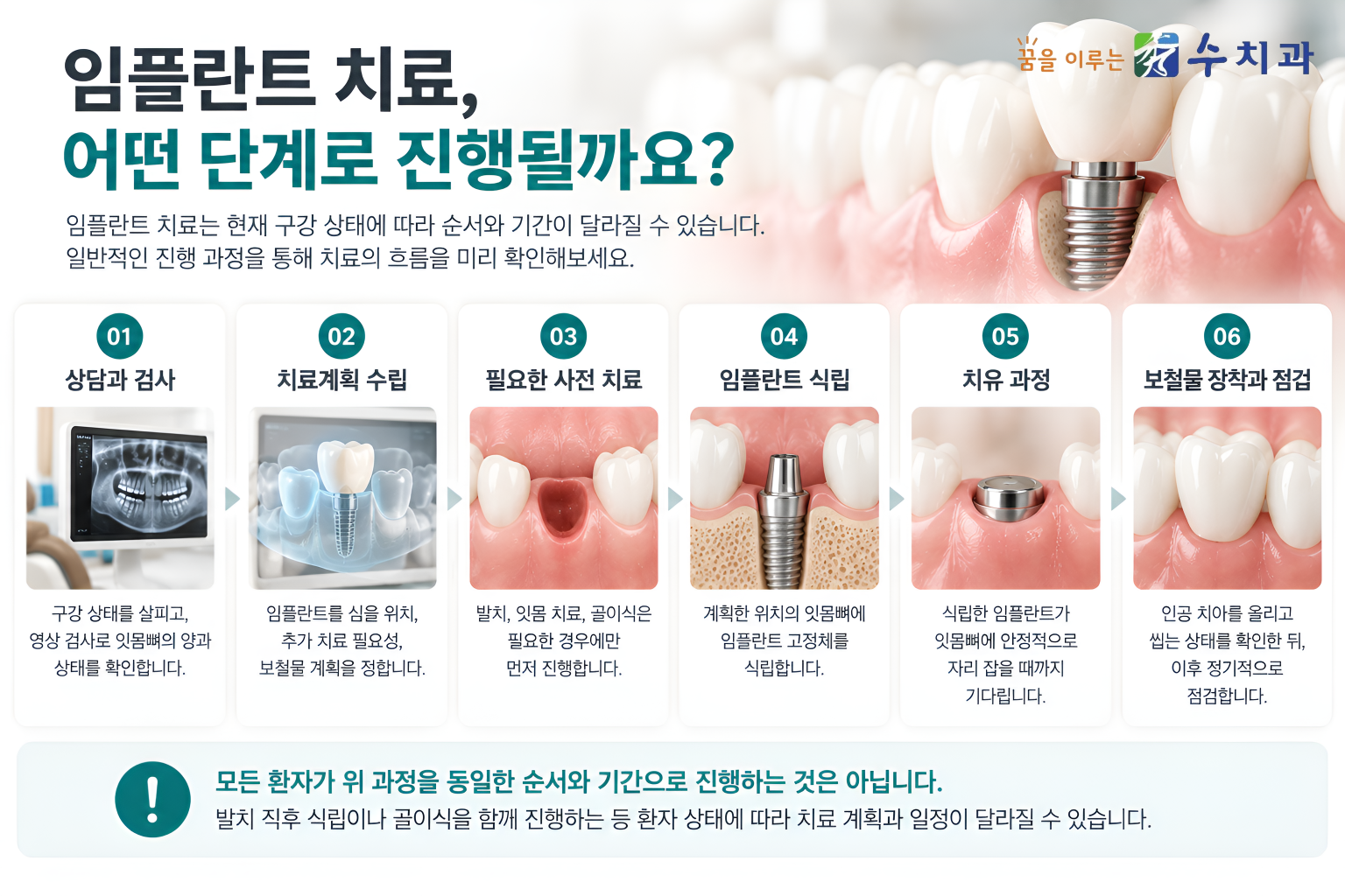 %25EA%25BF%2588%25EC%2588%2598_%25ED%2599%2588%25ED%2594%25BC%25B9%25BC%25EB%259F%25BC.png 임플란트 치료 6단계 상담과 검사 치료계획 사전 치료 식립 치유 보철물 장착 및 정기점검